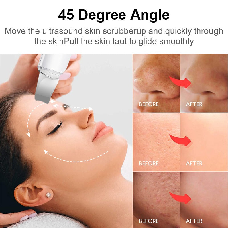 Ultrasonic Skin Spatula Facial Skin Scrubber β Deep Cleansing - Free Shipping